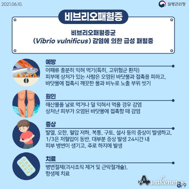 평택시 송탄보건소, 비브리오 패혈증 예방수칙 준수 당부