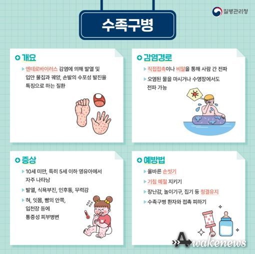 안산시, 영유아 수족구병 주의 당부…“예방수칙 준수해야”